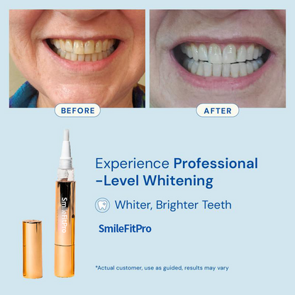 SmileBright™ Teeth Whitening Pen